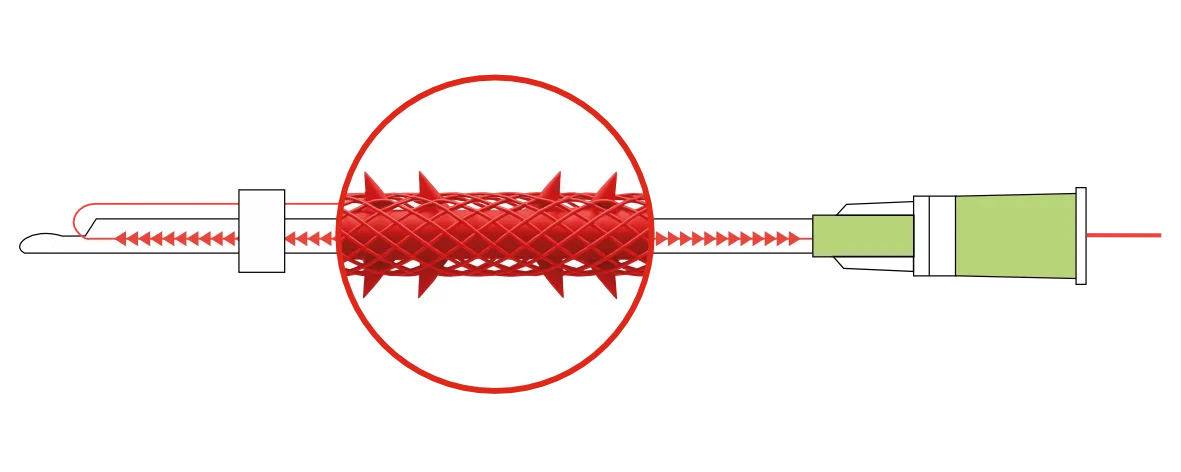 PLACL COG SC-type MESH LIFTING 18G-100мм 4шт/уп каркасн.цельнолитая с оформов.зубц+ 3D-сеть /DG-lift